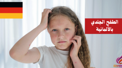 كيف تصف الطفح الجلدي بالألمانية