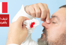J'ai le nez qui saigne نزيف الأنف بالفرنسية